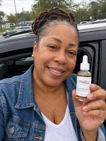 MELA customer