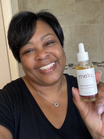 MELA customer